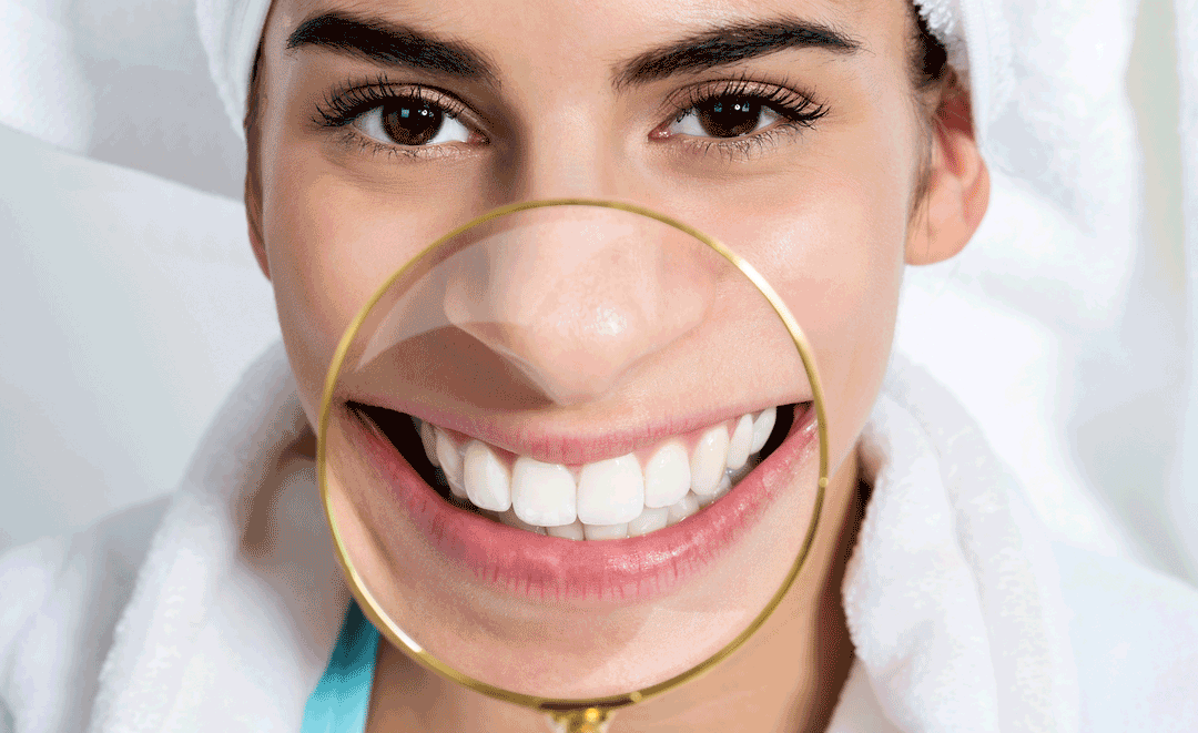 Teeth Whitening at Home or In-Office
